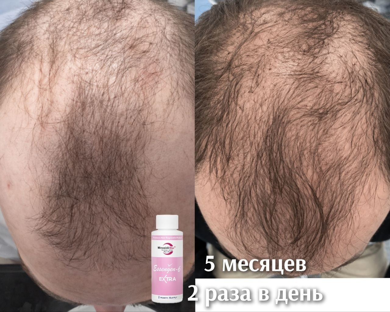 Результат Отчет после курсе Essengen