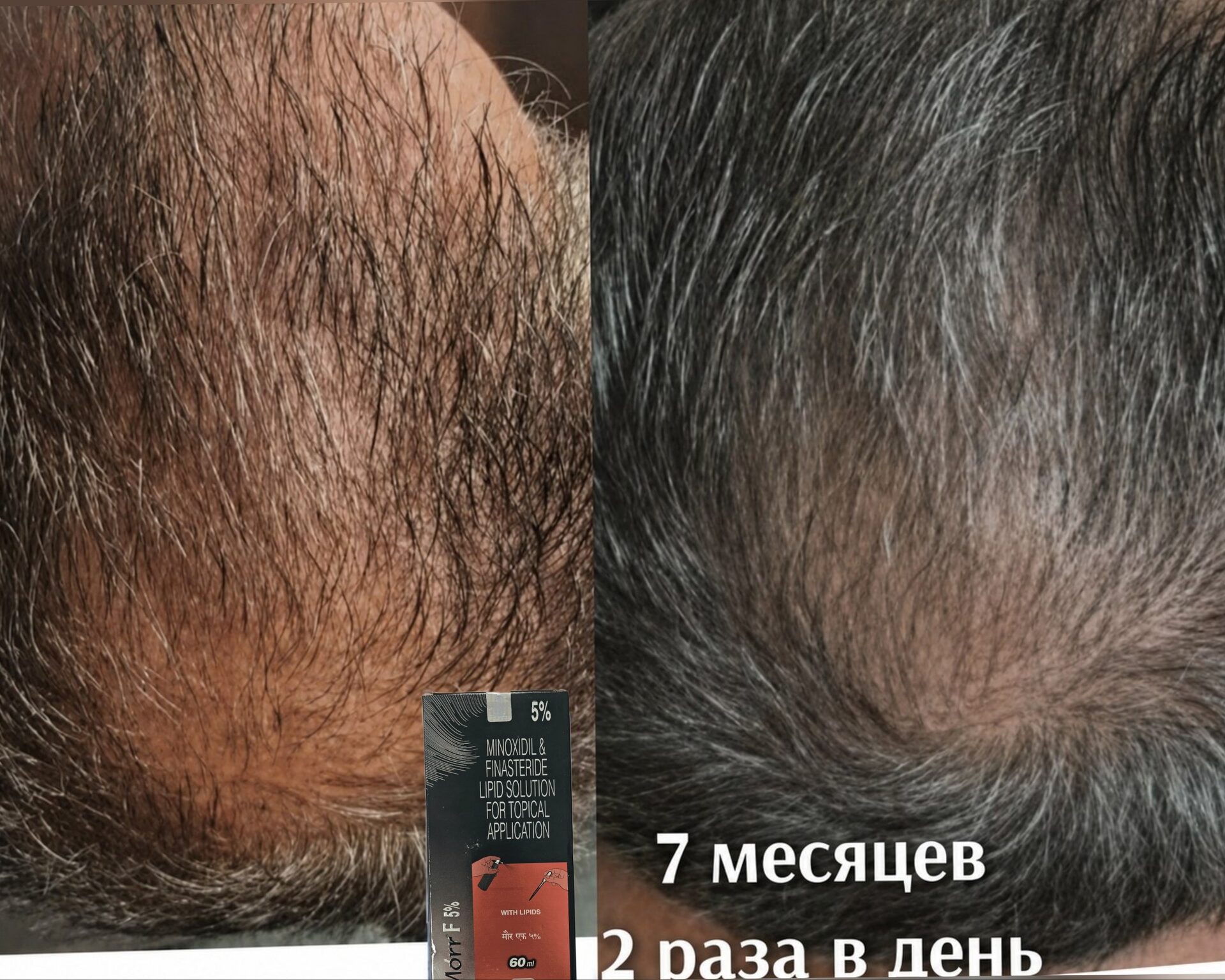 Результат Действие Morr F за 7 месяцев