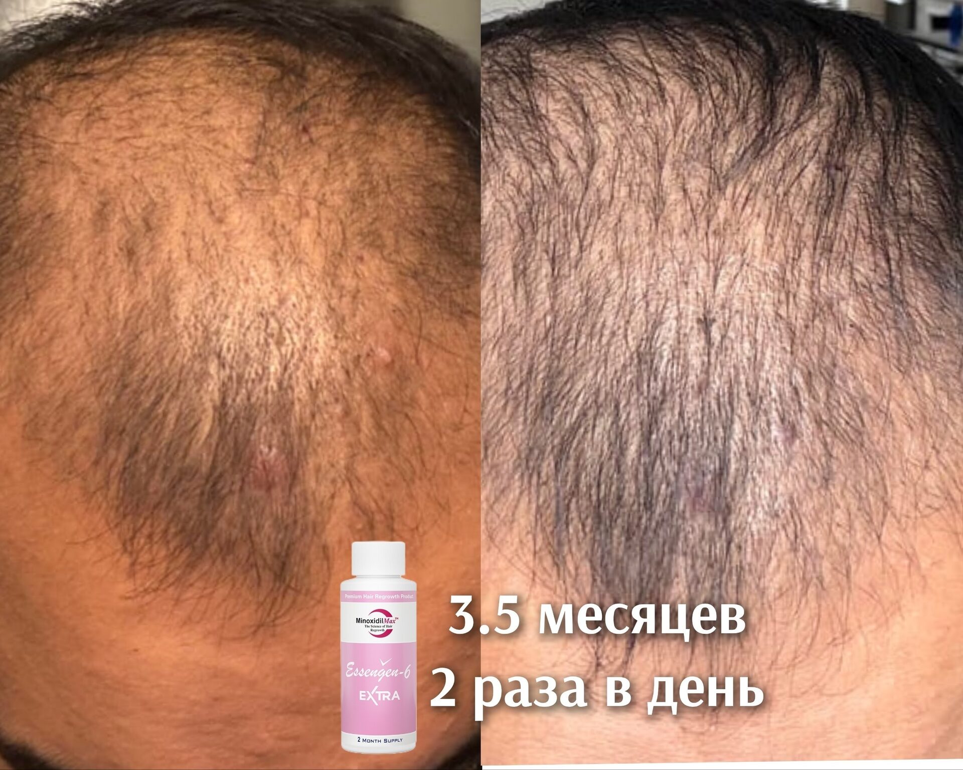 Результат Фотоотчёт от Арсена за 3,5 месяца