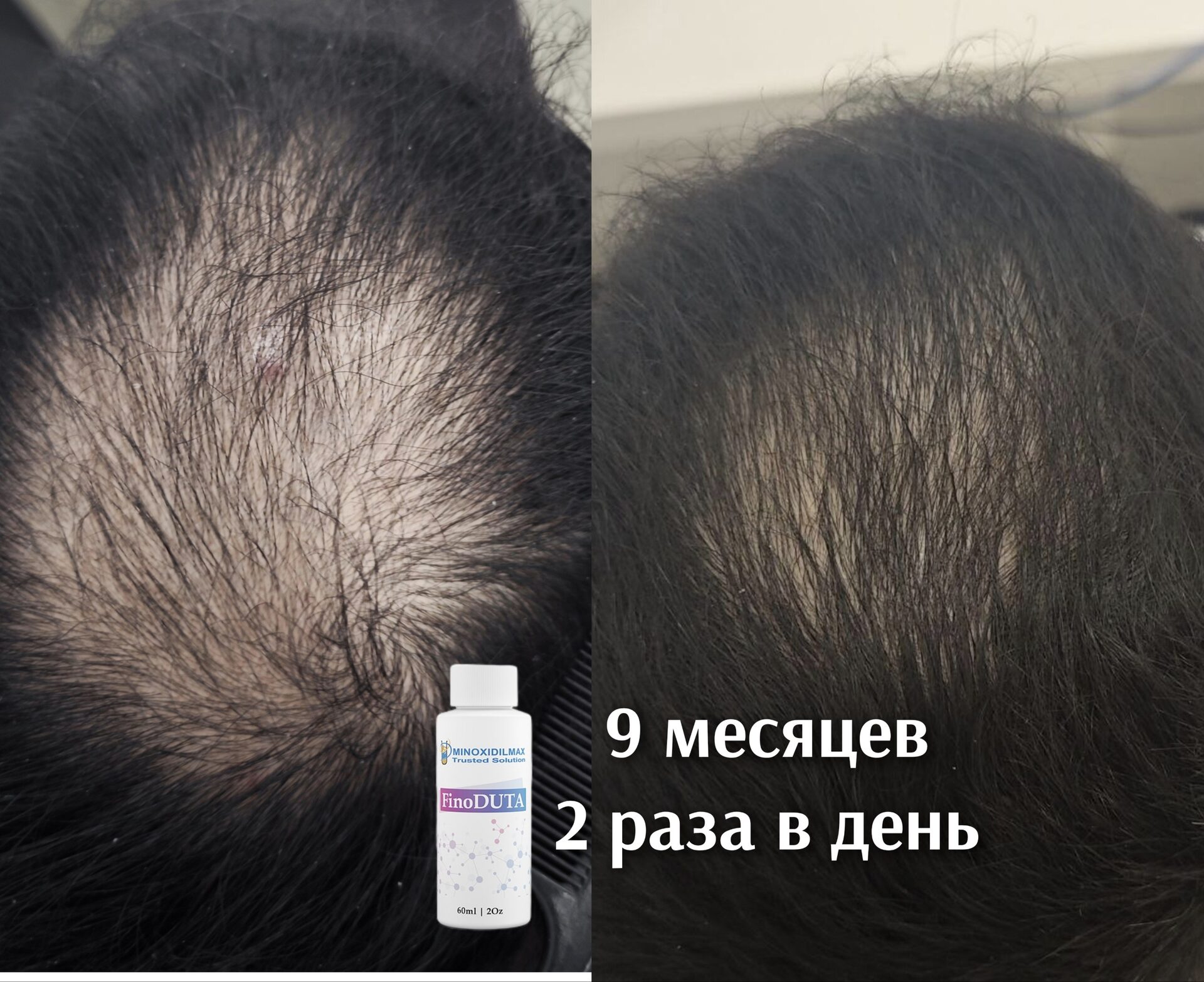 Результат Ежедневное использование Finoduta