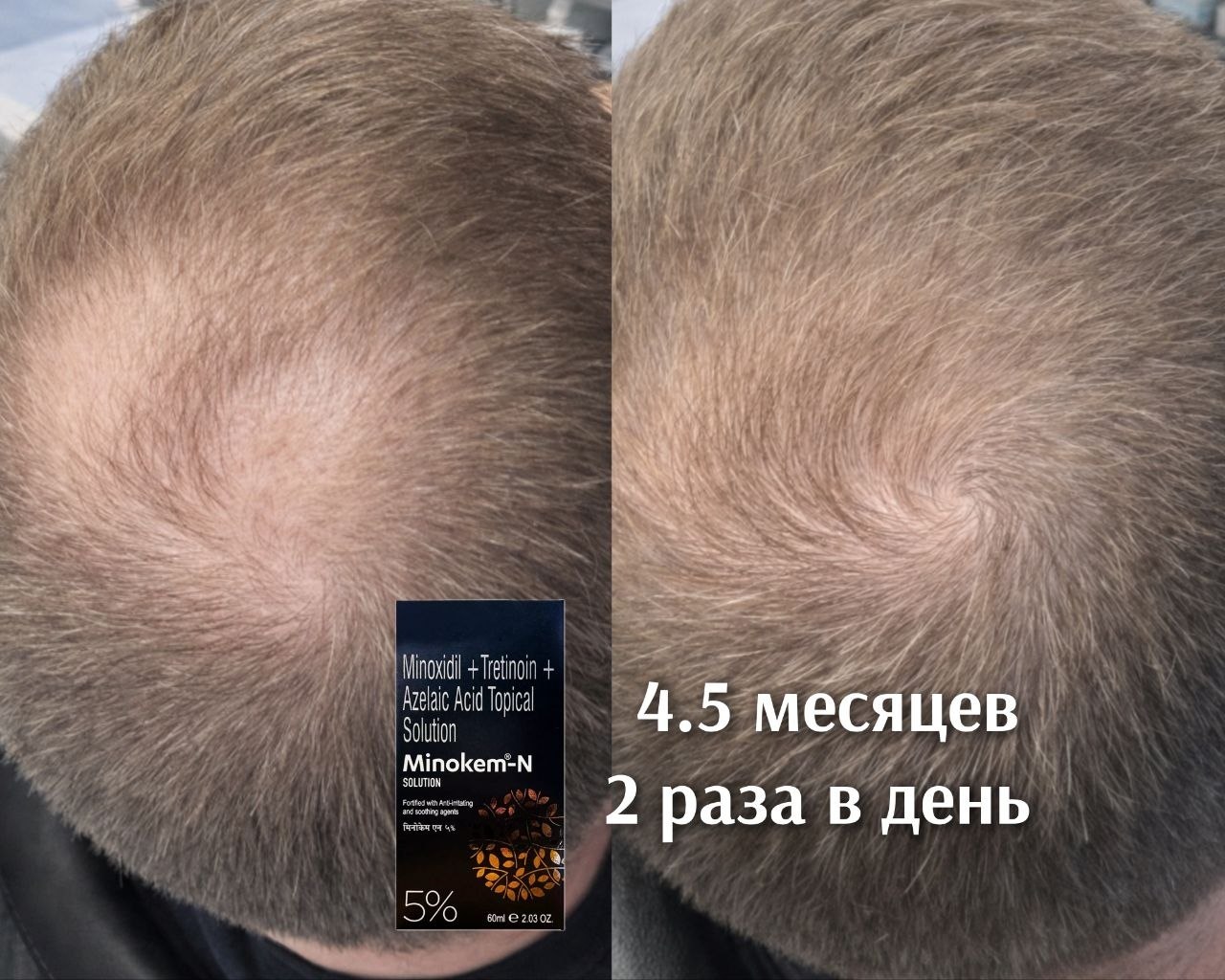 Результат Результаты Дмитрия за 5 месяцев