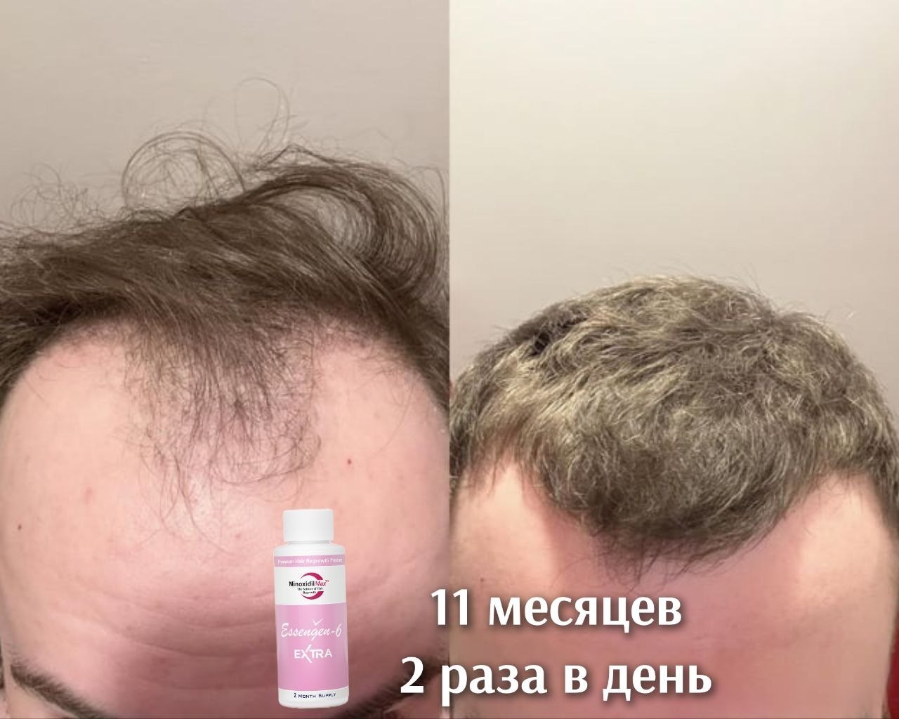 Результат Отзыв на полное восстановление густоты волос