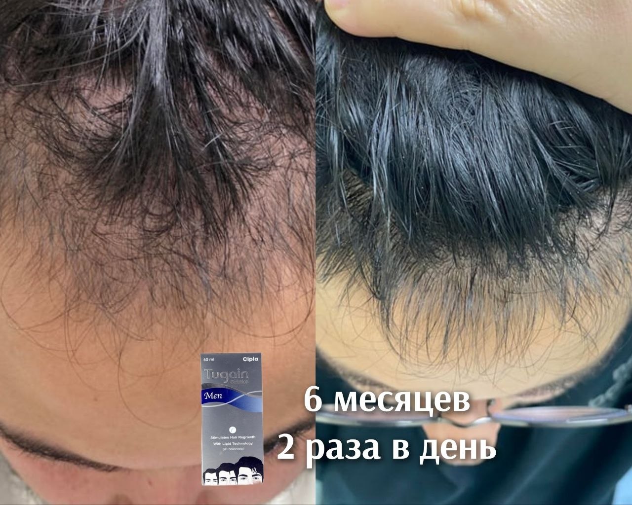 Результат Отзыв на Tugain с фото