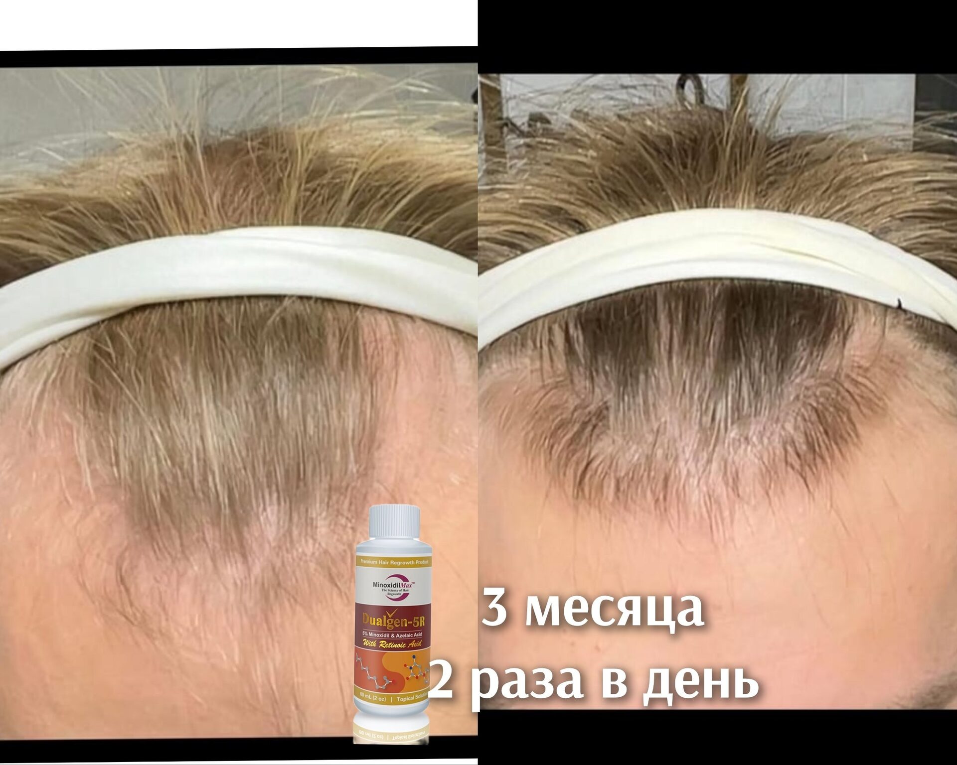 Результат Курс Dualgen 5R 5%